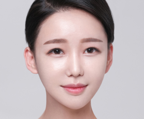 광대축소 수술 후
