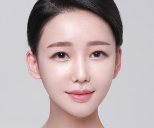 광대축소 수술 후