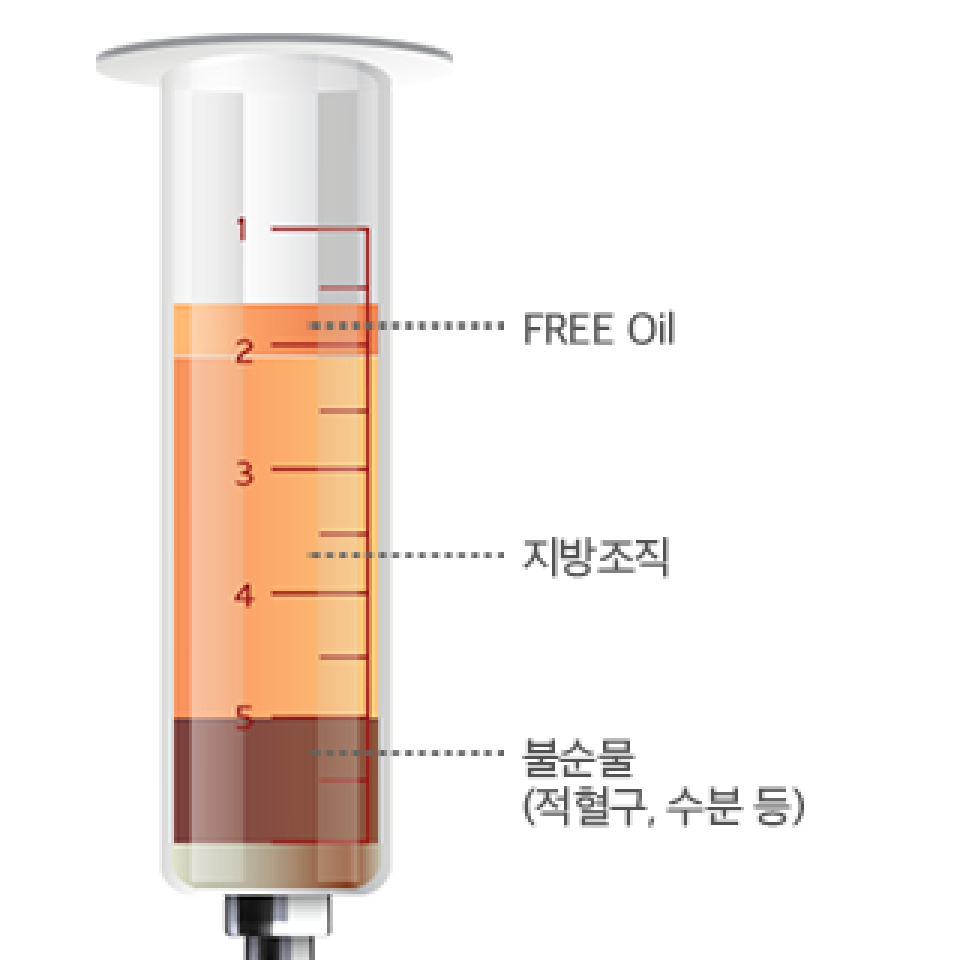일반 원심분리기 이미지