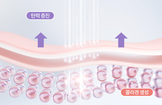 리엔장 팅쎄라 핵심포인트 4