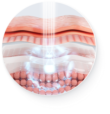 CoolFase Collagen Regeneration Principle Image