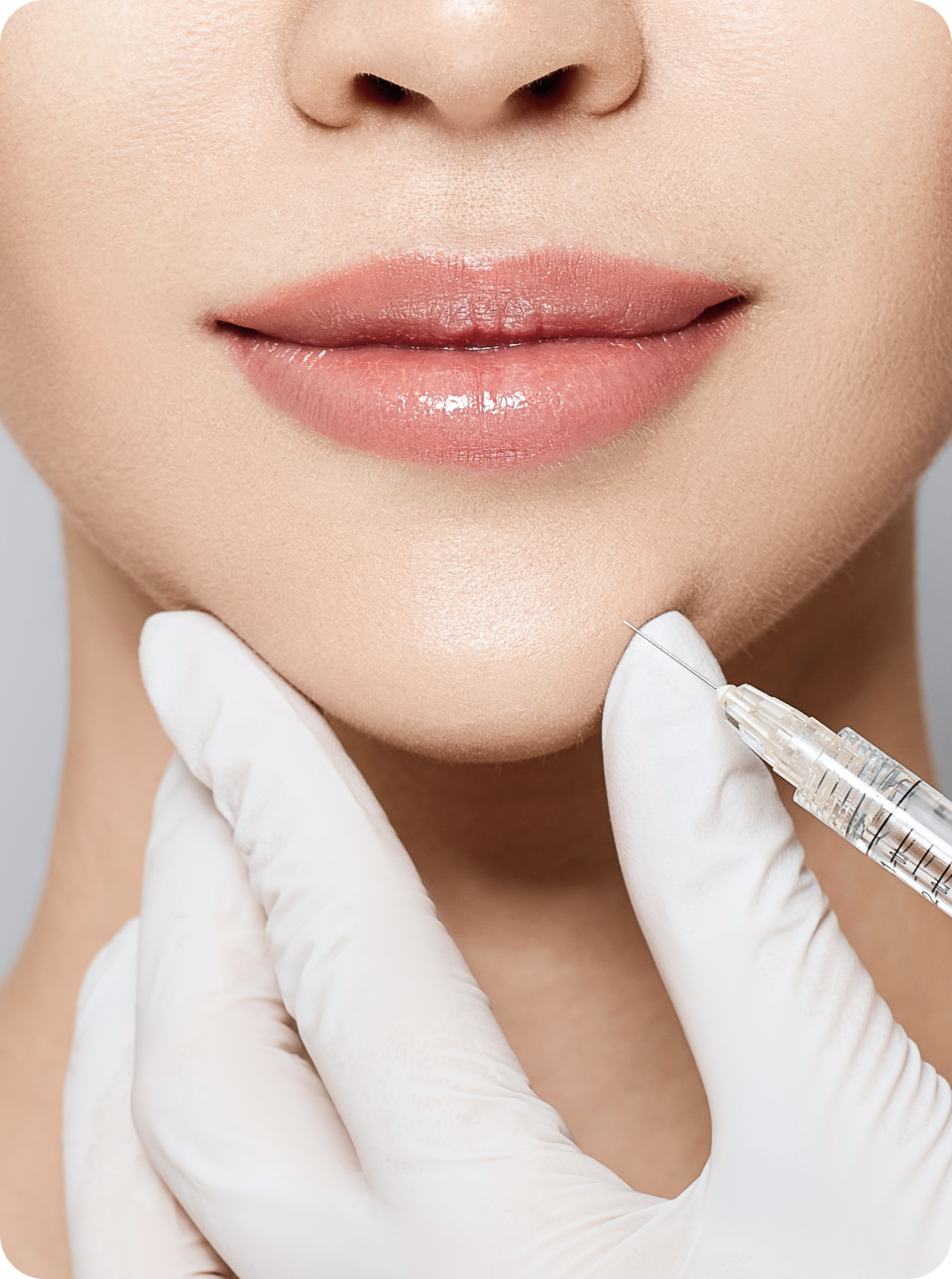 woman receiving dermal fillers