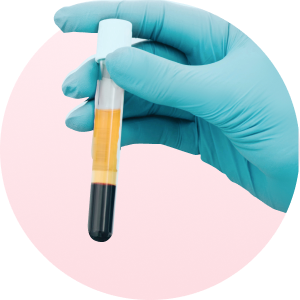 PPP Autologous Serum in a vial