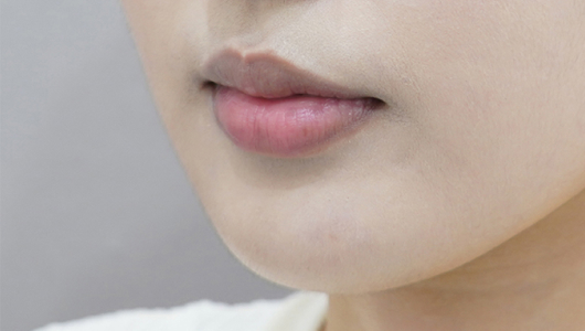 before filler treatment for curled-in lips