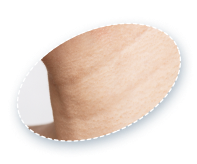 example of horizontal neck wrinkles