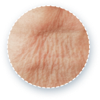 example of vertical neck wrinkles