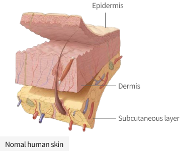diagram showing the layers of the skin