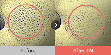 before and after images showing pore size improvement
