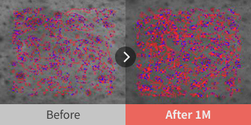before and after images showing skin thickness improvement