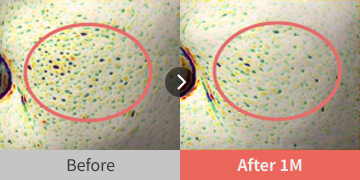 before and after images showing skin texture improvement
