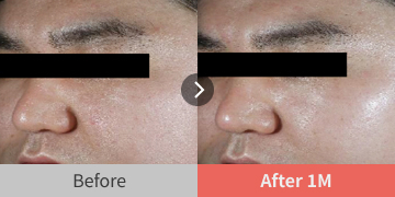before and after images showing radiance improvement