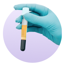 vial representing PPP autologous serum