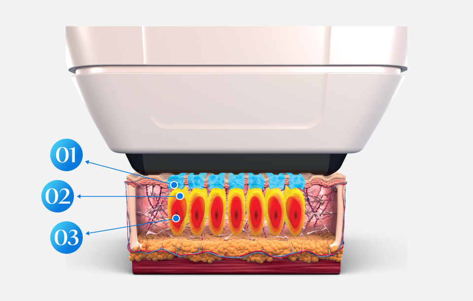 Description of Sofwave's Mobile SUPERB Technology