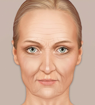 Example of a face in their 50s