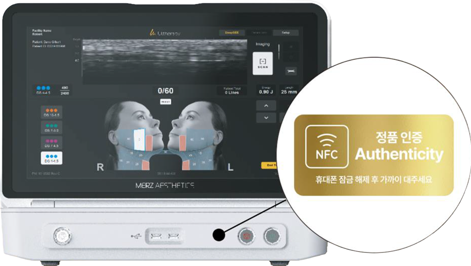 How to verify authentic Ultherapy Prime via NFC