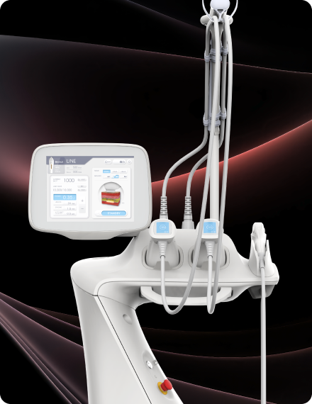 ultline hifu body contouring laser