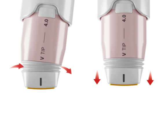 Treatment effect image of curved close-contact lifting through the Hidden Edge Tip